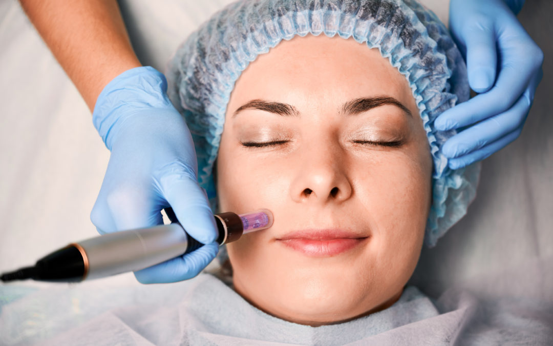 Exosome Therapy and Microneedling Triangle Eye Institute